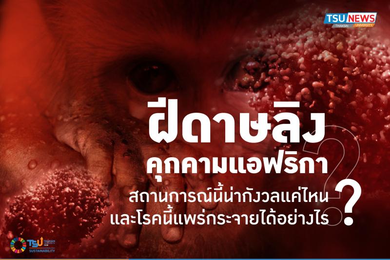 ฝีดาษลิงคุกคามแอฟริกา : สถานการณ์นี้น่ากังวลแค่ไหนและโรคนี้แพร่กระจายได้อย่างไร?